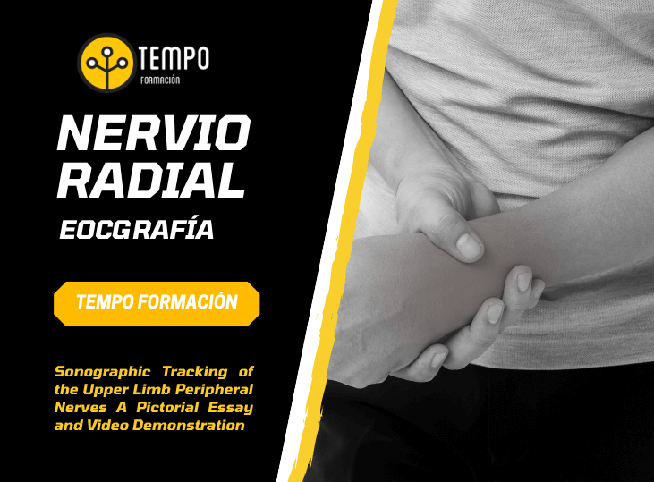 nervio-radial-y-ecografia